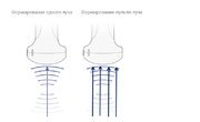 УЗИ аппарат Mindray DC-40 Общие исследования